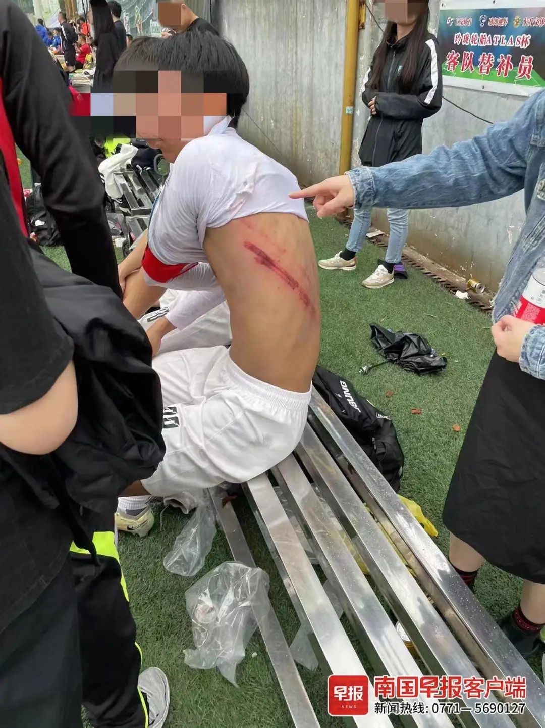 武汉卓尔足球队球员受伤离场